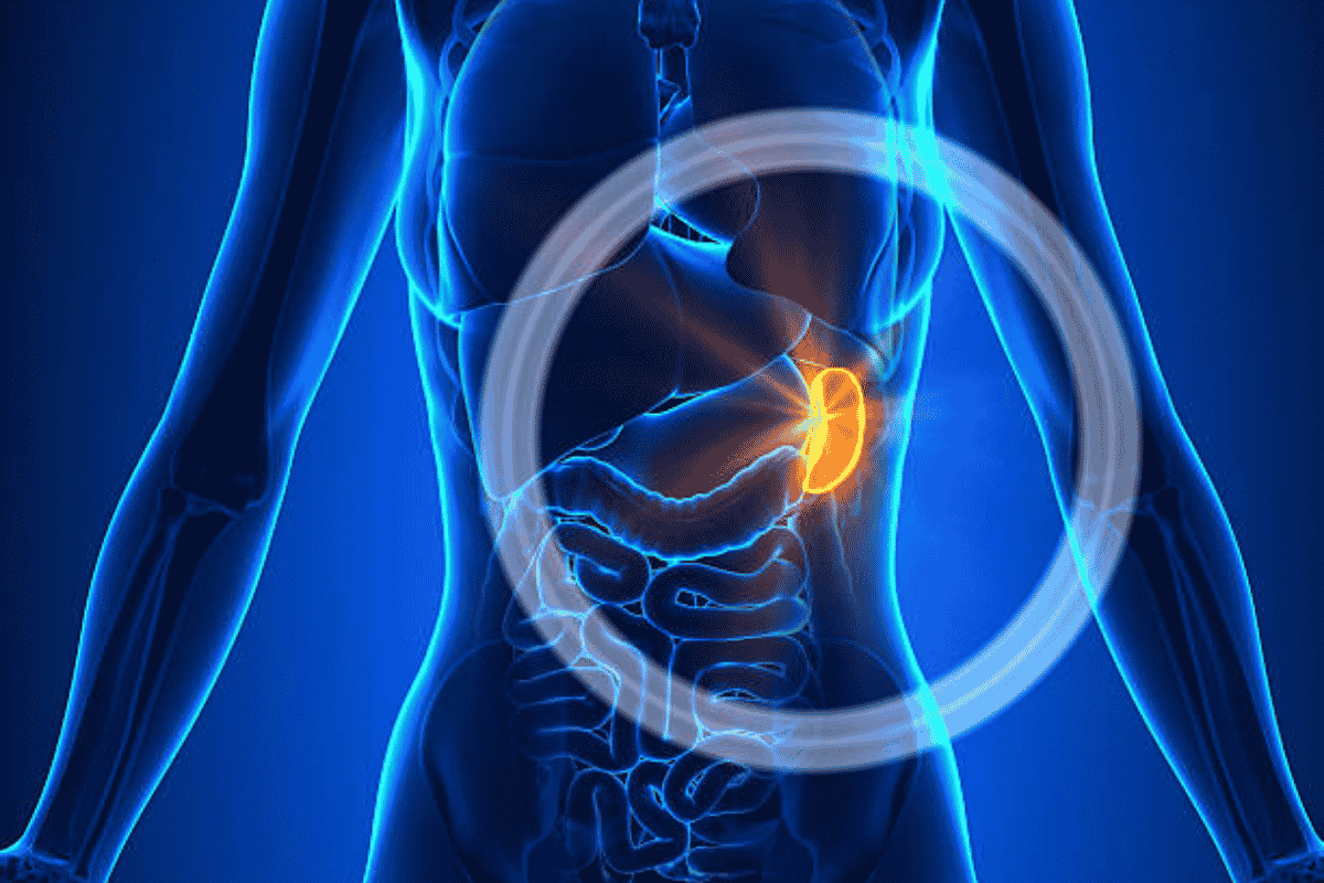 Spleen Surgery