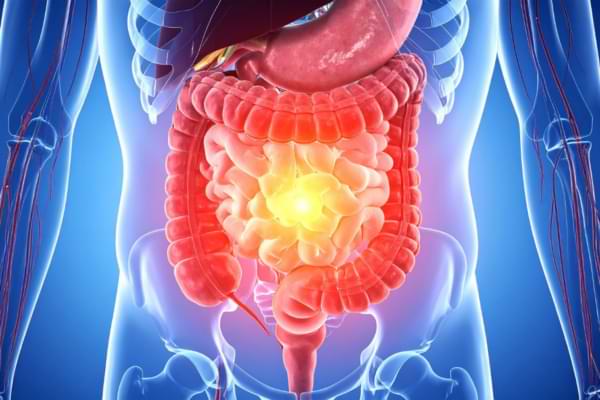 small and large intestine surgery in ahmedabad