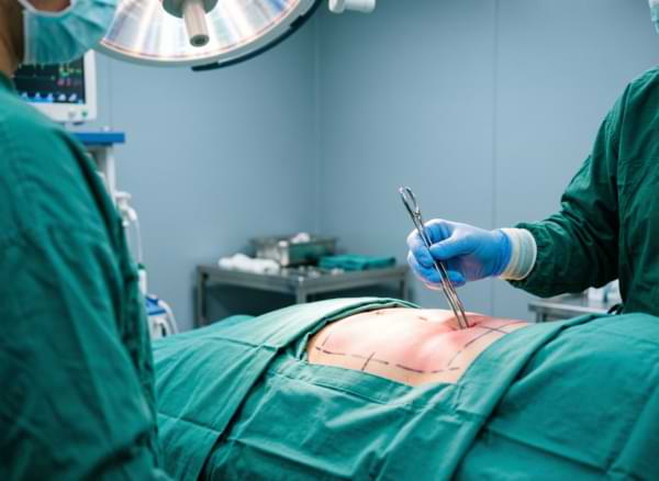 GI Surgery