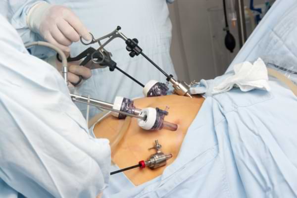 Bariatric and Metabolic Surgery in Ahmedabad